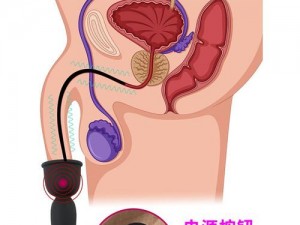 堵住尿孔不能尿按肚子知乎：男性成人用品情趣玩具